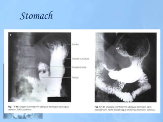 Digestive system imaging 1 class | PPTX