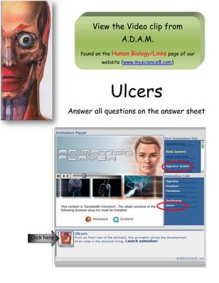 View the Video clip from
A.D.A.M.
found on the Human Biology/Links page of our
website (www.myscience8.com)
Ulcers
Answer all questions on the answer sheet
Click here
 