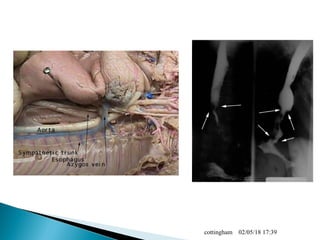 02/05/18 17:39cottingham
 