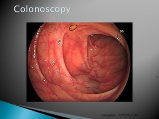 02/05/18 17:39cottingham
 