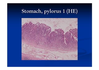 Digestive system part 2