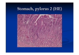 Digestive system part 2