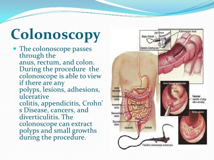 Digestive system presentation8