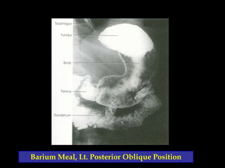 Digestive system radiography | PPSX
