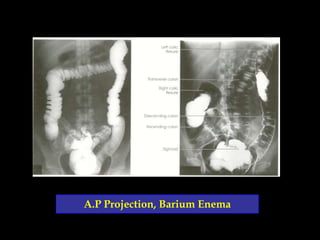 Digestive system radiography | PPSX