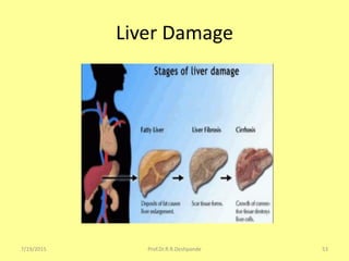 Liver Damage
7/19/2015 53Prof.Dr.R.R.Deshpande
 