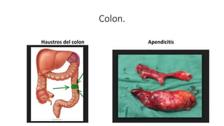 Colon.
Haustros del colon Apendicitis
 