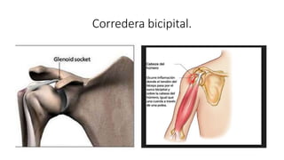 Corredera bicipital.
 