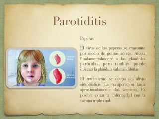 Paperas Inflamadas glandulas salivales | PDF