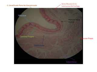 Acino Mucoso En la Submucosa Del Esófago E. Estratificado Plano No Queratinizado Mucosa Muscular de la mucosa Lamina Propia Muscular Propia Submucosa Adventicia 