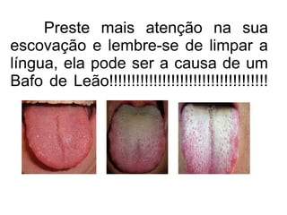 Preste mais atenção na sua 
escovação e lembre-se de limpar a 
língua, ela pode ser a causa de um 
Bafo de Leão!!!!!!!!!!!!!!!!!!!!!!!!!!!!!!!!!!!! 
 