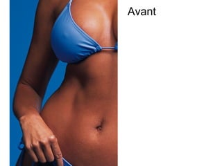 Avant
 