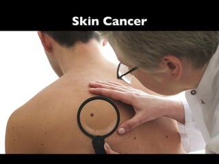 Skin Cancer
 