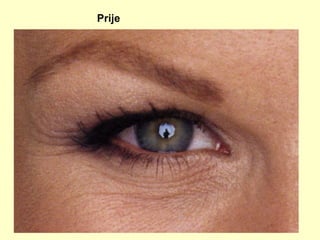 Prije 