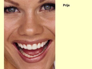 Prije 