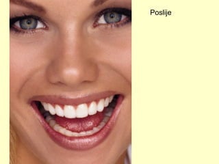 Poslije 