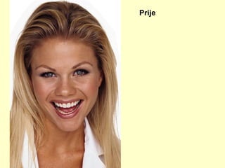 Prije 