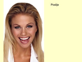 Poslije 
