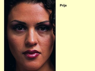 Prije 