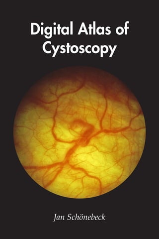 Jan Schönebeck
Digital Atlas of
Cystoscopy
 