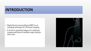 INTRODUCTION
• Digital breast tomosynthesis (DBT) is an
emerging technique for 3D breast imaging
• It involves acquiring images of a stationary
compressed breast at multiple angle during a
short scan.
 