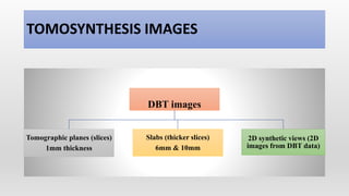 TOMOSYNTHESIS IMAGES
DBT images
Tomographic planes (slices)
1mm thickness
Slabs (thicker slices)
6mm & 10mm
2D synthetic views (2D
images from DBT data)
 