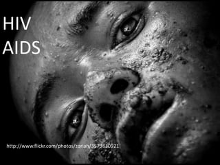 HIV
AIDS



http://www.flickr.com/photos/zoriah/3573830921
 