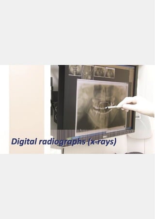 Digital dental x rays