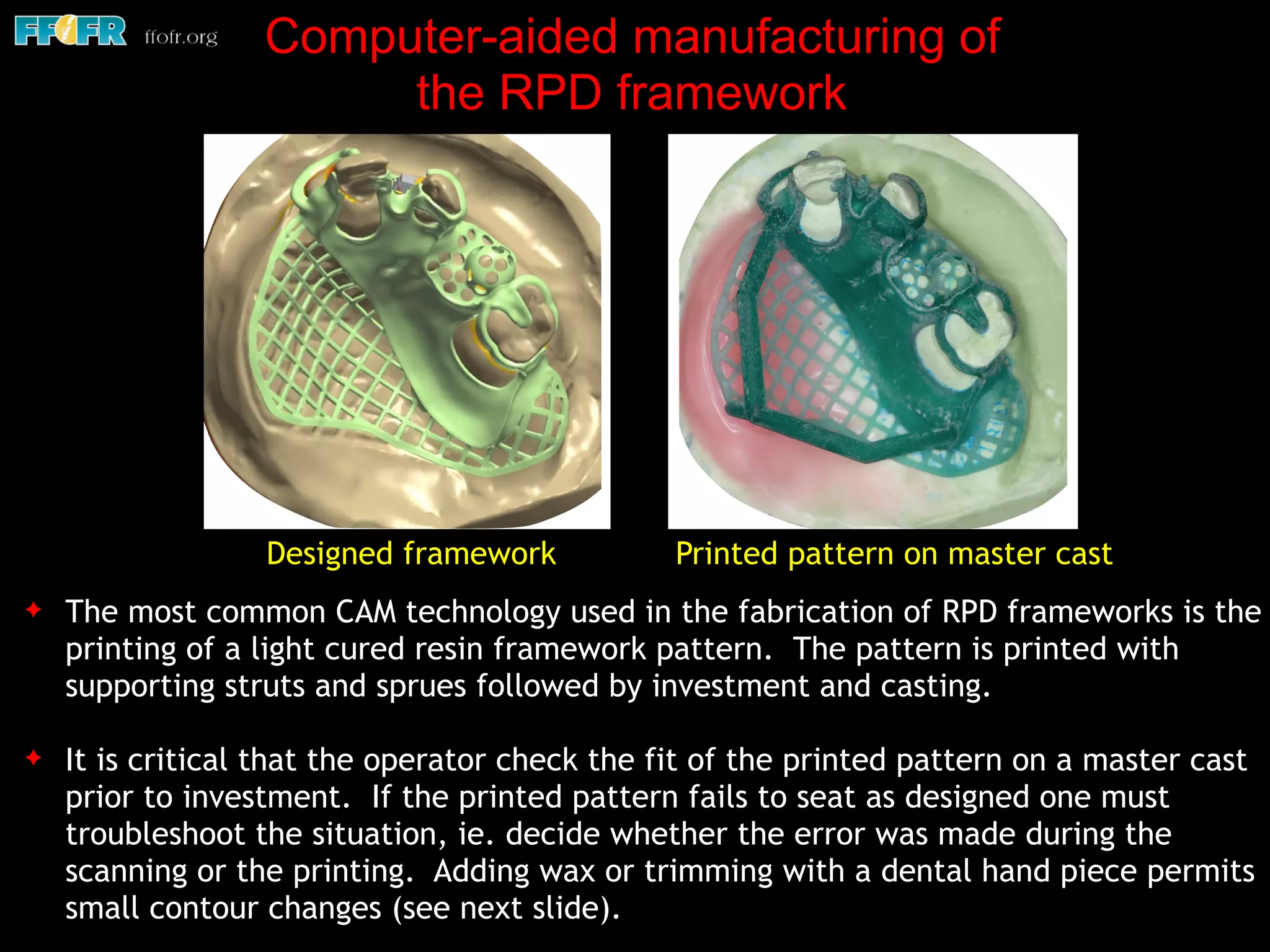 Computer-aided manufacturing of
the RPD framework
✦ The most common CAM technology used in the fabrication of RPD frameworks is the
printing of a light cured resin framework pattern. The pattern is printed with
supporting struts and sprues followed by investment and casting.
✦ It is critical that the operator check the fit of the printed pattern on a master cast
prior to investment. If the printed pattern fails to seat as designed one must
troubleshoot the situation, ie. decide whether the error was made during the
scanning or the printing. Adding wax or trimming with a dental hand piece permits
small contour changes (see next slide).
Designed framework Printed pattern on master cast
 