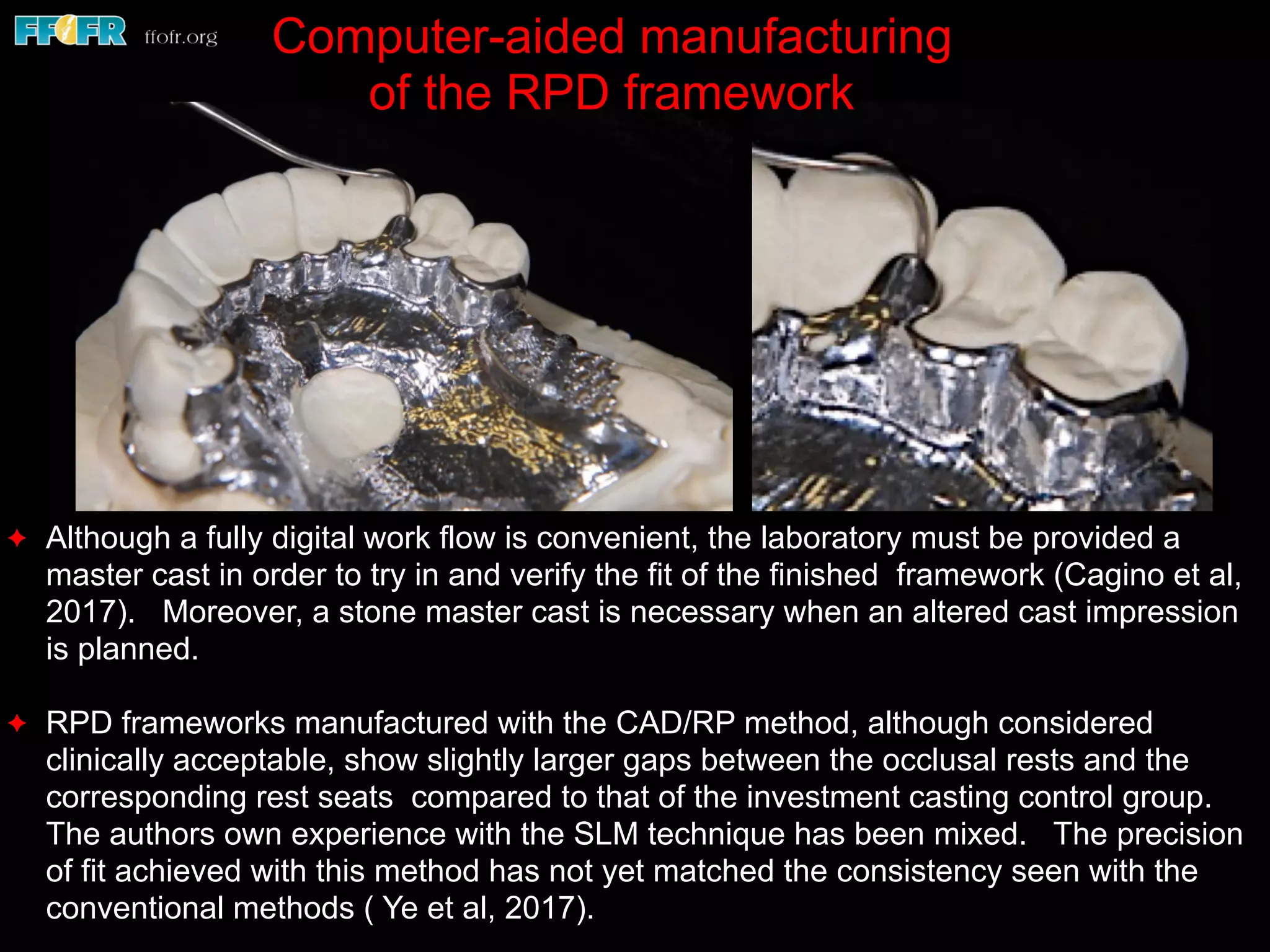 ✦ Although a fully digital work flow is convenient, the laboratory must be provided a
master cast in order to try in and verify the fit of the finished framework (Cagino et al,
2017). Moreover, a stone master cast is necessary when an altered cast impression
is planned.
✦ RPD frameworks manufactured with the CAD/RP method, although considered
clinically acceptable, show slightly larger gaps between the occlusal rests and the
corresponding rest seats compared to that of the investment casting control group.
The authors own experience with the SLM technique has been mixed. The precision
of fit achieved with this method has not yet matched the consistency seen with the
conventional methods ( Ye et al, 2017).
Computer-aided manufacturing
of the RPD framework
 