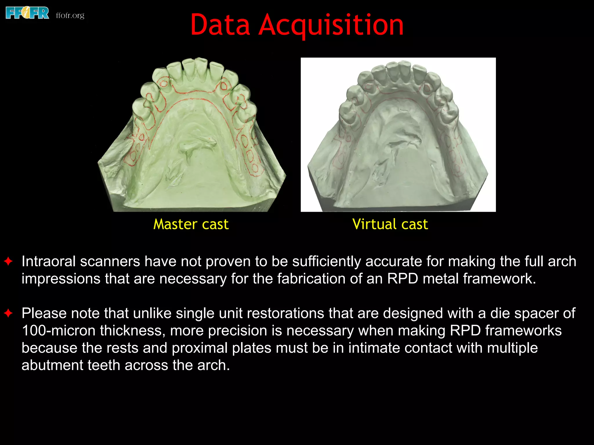 Data Acquisition
✦ Intraoral scanners have not proven to be sufficiently accurate for making the full arch
impressions that are necessary for the fabrication of an RPD metal framework.
✦ Please note that unlike single unit restorations that are designed with a die spacer of
100-micron thickness, more precision is necessary when making RPD frameworks
because the rests and proximal plates must be in intimate contact with multiple
abutment teeth across the arch.
Master cast Virtual cast
 