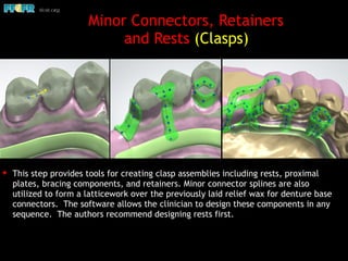 ✦ This step provides tools for creating clasp assemblies including rests, proximal
plates, bracing components, and retainers. Minor connector splines are also
utilized to form a latticework over the previously laid relief wax for denture base
connectors. The software allows the clinician to design these components in any
sequence. The authors recommend designing rests first.
Minor Connectors, Retainers
and Rests (Clasps)
 