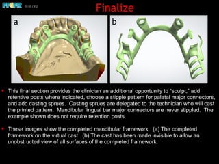 ✦ This final section provides the clinician an additional opportunity to “sculpt,” add
retentive posts where indicated, choose a stipple pattern for palatal major connectors,
and add casting sprues. Casting sprues are delegated to the technician who will cast
the printed pattern. Mandibular lingual bar major connectors are never stippled. The
example shown does not require retention posts.
✦ These images show the completed mandibular framework. (a) The completed
framework on the virtual cast. (b) The cast has been made invisible to allow an
unobstructed view of all surfaces of the completed framework.
Finalize
a b
 