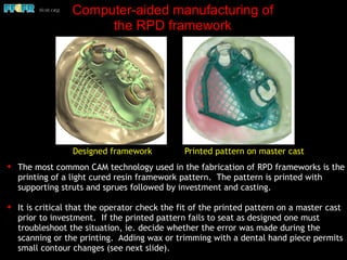 Computer-aided manufacturing of
the RPD framework
✦ The most common CAM technology used in the fabrication of RPD frameworks is the
printing of a light cured resin framework pattern. The pattern is printed with
supporting struts and sprues followed by investment and casting.
✦ It is critical that the operator check the fit of the printed pattern on a master cast
prior to investment. If the printed pattern fails to seat as designed one must
troubleshoot the situation, ie. decide whether the error was made during the
scanning or the printing. Adding wax or trimming with a dental hand piece permits
small contour changes (see next slide).
Designed framework Printed pattern on master cast
 