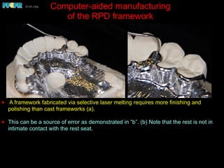 ✦ A framework fabricated via selective laser melting requires more finishing and
polishing than cast frameworks (a).
✦ This can be a source of error as demonstrated in “b”. (b) Note that the rest is not in
intimate contact with the rest seat.
Computer-aided manufacturing
of the RPD framework
 