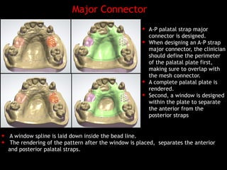 Palatable Strap Rpd Digital design of maxillary of rpd's | PDF