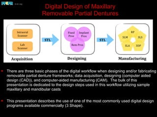 Max Rpd Digital design of maxillary of rpd's | PDF