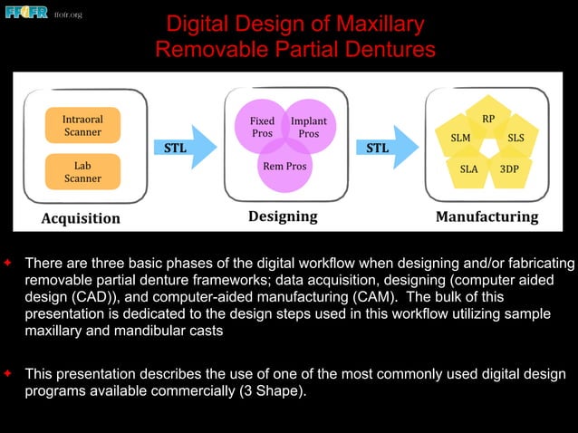 Digital design of maxillary of rpd's | PDF