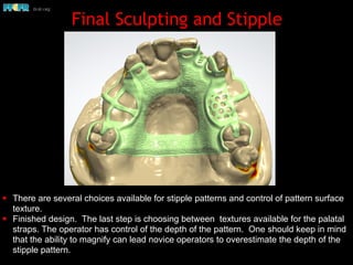 Digital design of maxillary of rpd's | PDF