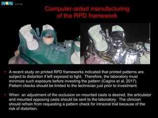Max Rpd Framework Digital design of maxillary of rpd's | PDF
