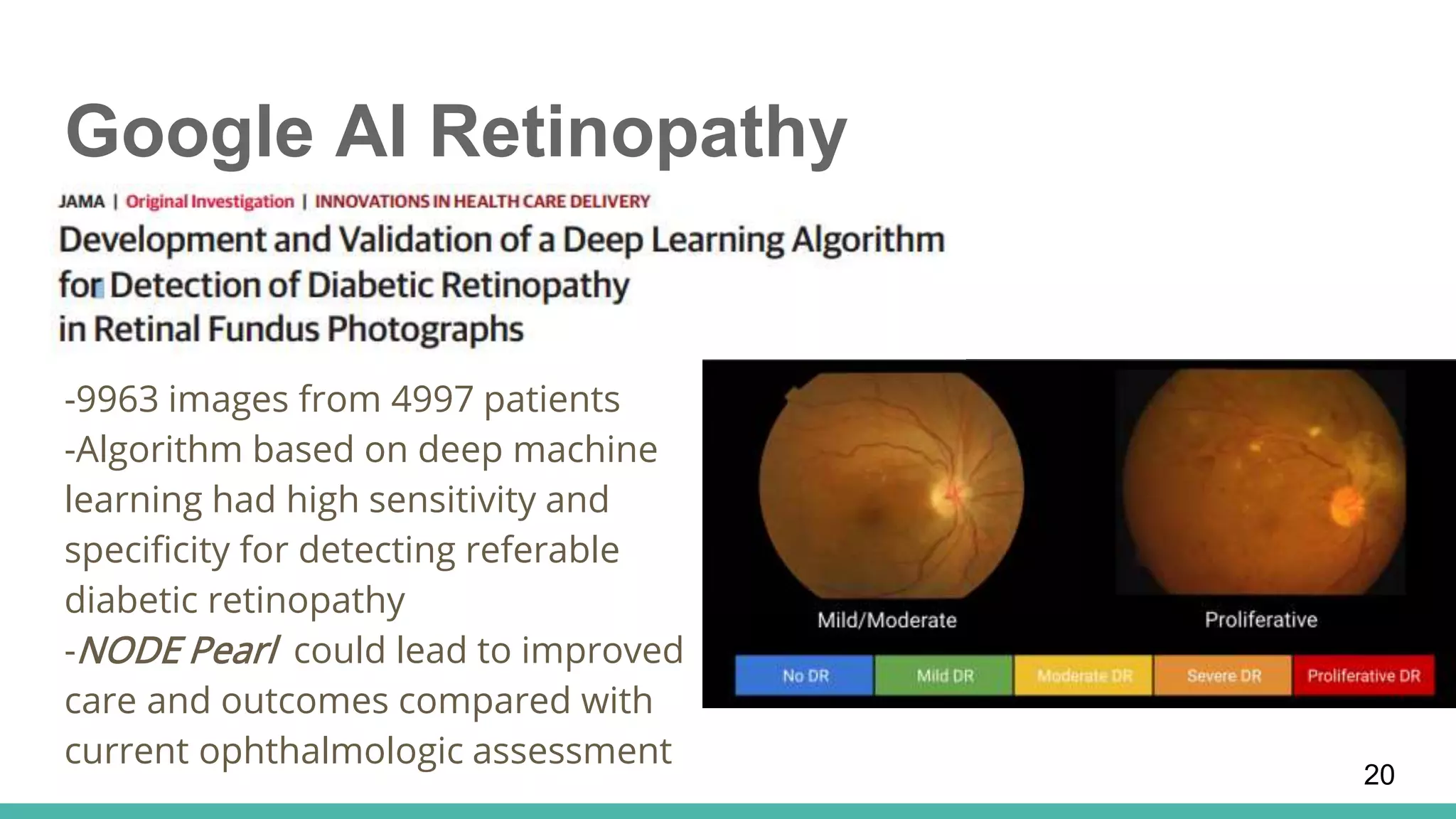 Google AI Retinopathy
-9963 images from 4997 patients
-Algorithm based on deep machine
learning had high sensitivity and
specificity for detecting referable
diabetic retinopathy
-NODE Pearl could lead to improved
care and outcomes compared with
current ophthalmologic assessment
20
 