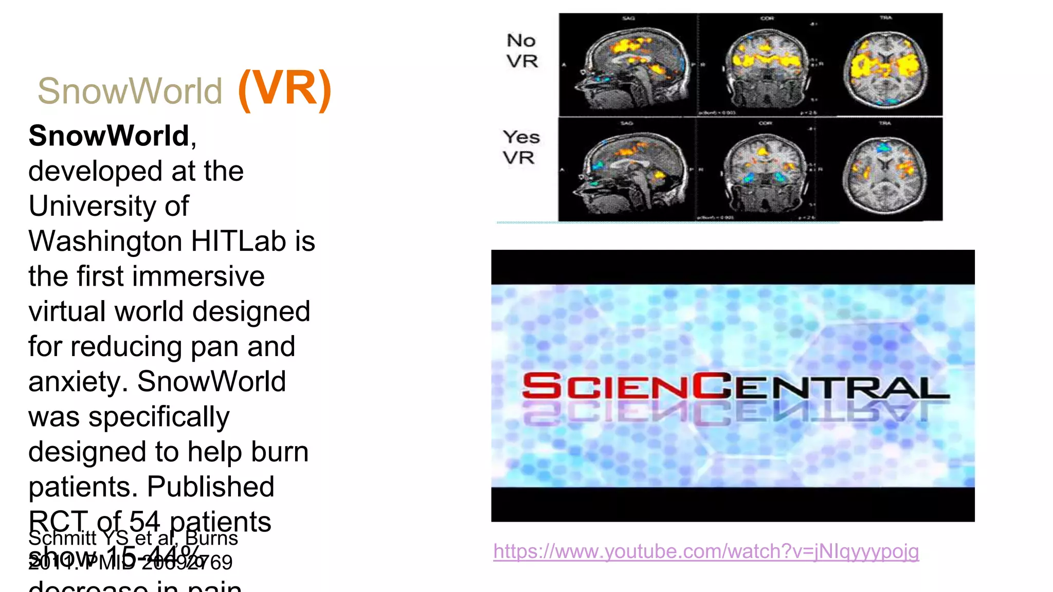 SnowWorld (VR)
SnowWorld,
developed at the
University of
Washington HITLab is
the first immersive
virtual world designed
for reducing pan and
anxiety. SnowWorld
was specifically
designed to help burn
patients. Published
RCT of 54 patients
show 15-44%
Schmitt YS et al, Burns
2011. PMID 20692769
https://www.youtube.com/watch?v=jNIqyyypojg
 
