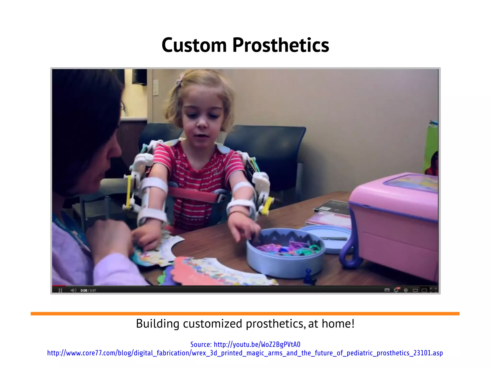 Custom Prosthetics




                           Building customized prosthetics, at home!
                                              Source: http://youtu.be/WoZ2BgPVtA0
http://www.core77.com/blog/digital_fabrication/wrex_3d_printed_magic_arms_and_the_future_of_pediatric_prosthetics_23101.asp
 