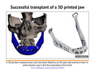 Successful transplant of a 3D printed jaw




A 3D printer-created lower jaw has been ftted to an 83-year-old woman's face in
                what doctors say is the frst operation of its kind.
                       Source: http://www.bbc.co.uk/news/technology-16907104
 
