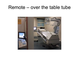 Remote – over the table tube 