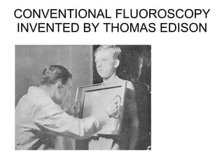 CONVENTIONAL FLUOROSCOPY INVENTED BY THOMAS EDISON 