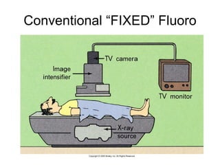Conventional “FIXED” Fluoro 