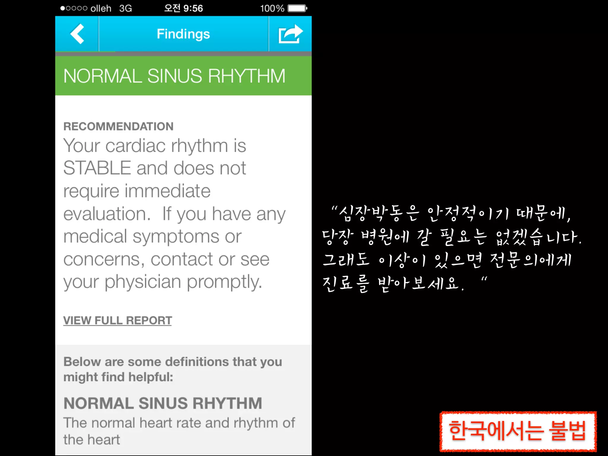 “심장박동은 안정적이기 때문에,  
당장 병원에 갈 필요는 없겠습니다.  
그래도 이상이 있으면 전문의에게  
진료를 받아보세요. “
한국에서는 불법한국에서는 불법
 