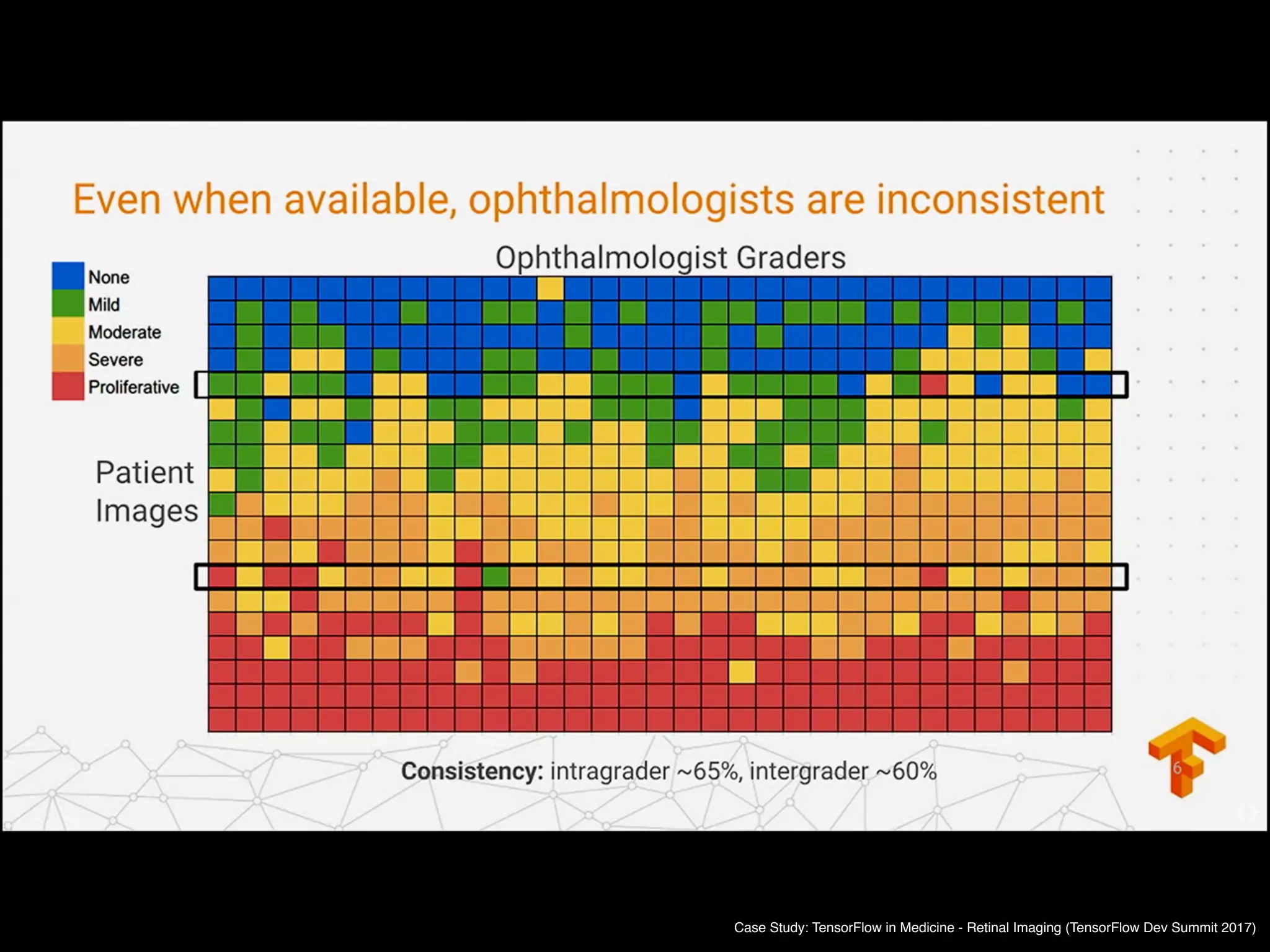 Case Study: TensorFlow in Medicine - Retinal Imaging (TensorFlow Dev Summit 2017)
 