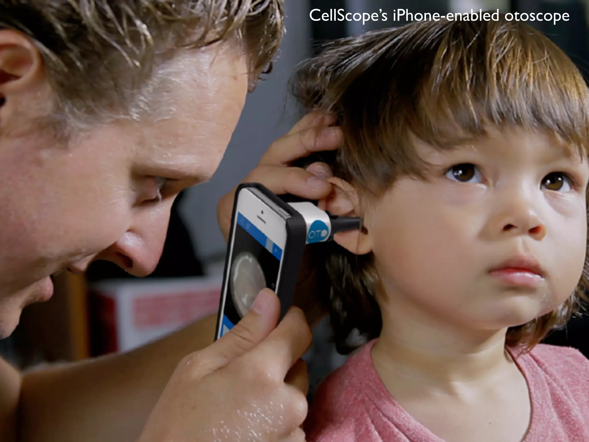 CellScope’s iPhone-enabled otoscope
 